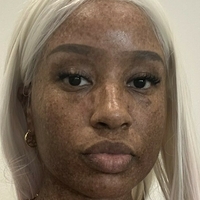 freckledn Nagie