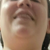 raventriplex Nagie