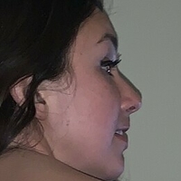 Ronisofine Nagie